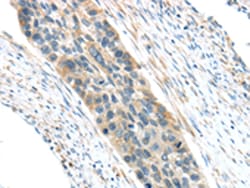 Invitrogen VWCE Polyclonal Antibody 100 &mu;L; Unconjugated:Antibodies,