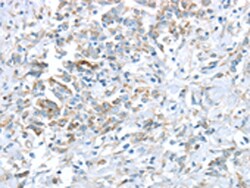 Invitrogen VWCE Polyclonal Antibody 100 &mu;L; Unconjugated:Antibodies,