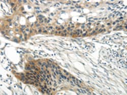 Invitrogen WNT6 Polyclonal Antibody 100 &mu;L; Unconjugated:Antibodies,