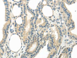 Invitrogen WNT6 Polyclonal Antibody 100 &mu;L; Unconjugated:Antibodies,