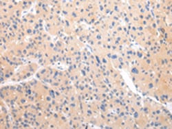 Invitrogen ZNF106 Polyclonal Antibody 100 &mu;L; Unconjugated:Antibodies,