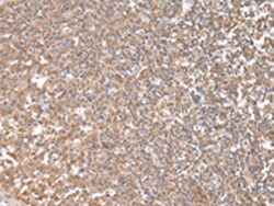 Invitrogen CPT1C Polyclonal Antibody 100 &mu;L; Unconjugated:Antibodies,
