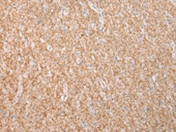 Invitrogen Dysferlin Polyclonal Antibody 100 &mu;L; Unconjugated:Antibodies,