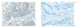 Invitrogen HTR2A Polyclonal Antibody 100 &mu;L; Unconjugated:Antibodies,