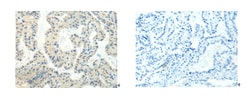 Invitrogen HTR2A Polyclonal Antibody 100 &mu;L; Unconjugated:Antibodies,