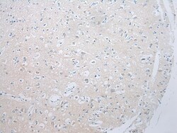 Invitrogen ADAMTS8 Polyclonal Antibody 100 &mu;L; Unconjugated:Antibodies,
