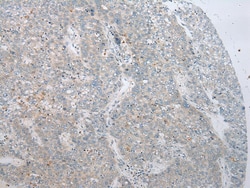 Invitrogen ADAMTS8 Polyclonal Antibody 100 &mu;L; Unconjugated:Antibodies,