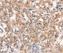 Invitrogen EID3 Polyclonal Antibody 100 &mu;L; Unconjugated:Antibodies,