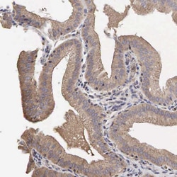 Invitrogen PABPC5 Polyclonal Antibody 100 &mu;L; Unconjugated:Antibodies,