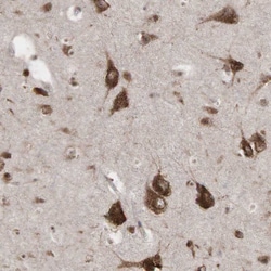 Invitrogen PABPC5 Polyclonal Antibody 100 &mu;L; Unconjugated:Antibodies,