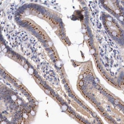 Invitrogen SYAP1 Polyclonal Antibody 100 &mu;L; Unconjugated:Antibodies,