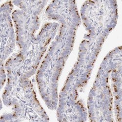 Invitrogen alpha Galactosidase Polyclonal Antibody 100 &mu;L; Unconjugated:Antibodies,