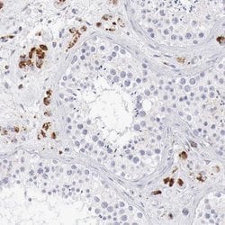 Invitrogen alpha Galactosidase Polyclonal Antibody 100 &mu;L; Unconjugated:Antibodies,