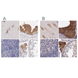 Invitrogen NSDHL Polyclonal Antibody 100 &mu;L; Unconjugated:Antibodies,