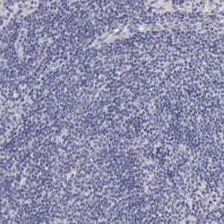 Invitrogen NSDHL Polyclonal Antibody 100 &mu;L; Unconjugated:Antibodies,