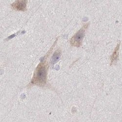 Invitrogen NSDHL Polyclonal Antibody 100 &mu;L; Unconjugated:Antibodies,