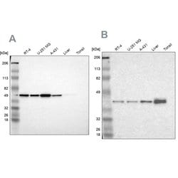 Invitrogen NSDHL Polyclonal Antibody 100 &mu;L; Unconjugated:Antibodies,