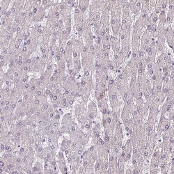 Invitrogen CHRDL1 Polyclonal Antibody 100 &mu;L; Unconjugated:Antibodies,