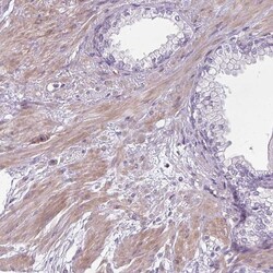 Invitrogen CHRDL1 Polyclonal Antibody 100 &mu;L; Unconjugated:Antibodies,