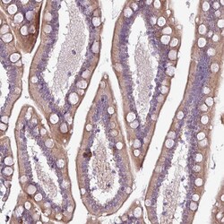 Invitrogen CHRDL1 Polyclonal Antibody 100 &mu;L; Unconjugated:Antibodies,