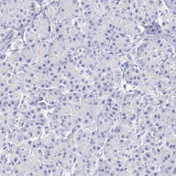 Invitrogen RFP2 Polyclonal Antibody 100 &mu;L; Unconjugated:Antibodies,