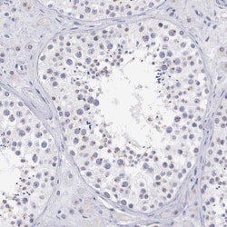 Invitrogen RFP2 Polyclonal Antibody 100 &mu;L; Unconjugated:Antibodies,
