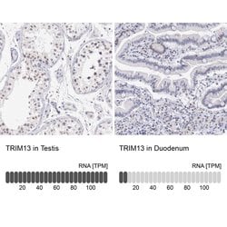 Invitrogen RFP2 Polyclonal Antibody 100 &mu;L; Unconjugated:Antibodies,