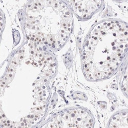 Invitrogen RFP2 Polyclonal Antibody 100 &mu;L; Unconjugated:Antibodies,