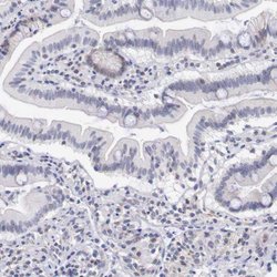 Invitrogen RFP2 Polyclonal Antibody 100 &mu;L; Unconjugated:Antibodies,