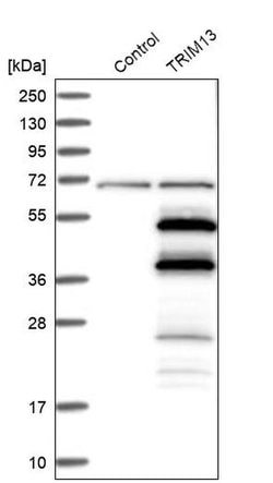Invitrogen RFP2 Polyclonal Antibody 100 &mu;L; Unconjugated:Antibodies,