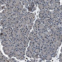 Invitrogen TMX4 Polyclonal Antibody 100 &mu;L; Unconjugated:Antibodies,