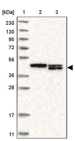 Invitrogen TMX4 Polyclonal Antibody 100 &mu;L; Unconjugated:Antibodies,
