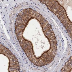 Invitrogen ZNF185 Polyclonal Antibody 100 &mu;L; Unconjugated:Antibodies,