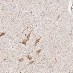 Invitrogen CLC-5 Polyclonal Antibody 100 &mu;L | Buy Online | Invitrogen&trade; | Fisher Scientific