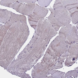 Invitrogen ARHGAP12 Polyclonal Antibody 100 &mu;L | Buy Online | Invitrogen&trade; | Fisher Scientific
