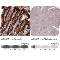Invitrogen ARHGAP12 Polyclonal Antibody 100 &mu;L | Buy Online | Invitrogen&trade; | Fisher Scientific