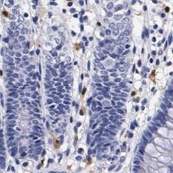 Invitrogen RENBP Polyclonal Antibody 100 &mu;L | Buy Online | Invitrogen&trade; | Fisher Scientific