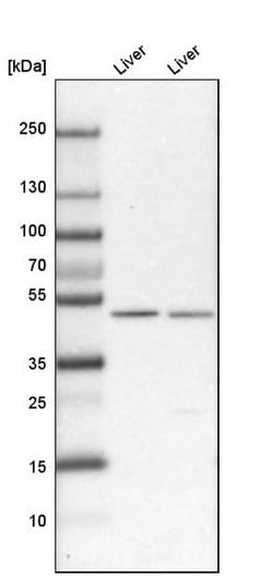 Invitrogen RENBP Polyclonal Antibody 100 &mu;L | Buy Online | Invitrogen&trade; | Fisher Scientific