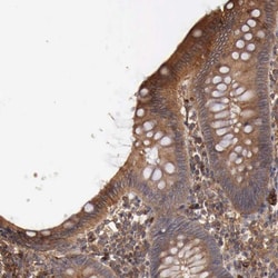 Invitrogen ARMCX4 Polyclonal Antibody 100 &mu;L; Unconjugated:Antibodies,