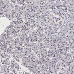 Invitrogen MORC2 Polyclonal Antibody 100 &mu;L; Unconjugated:Antibodies,