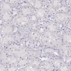 Invitrogen TKTL1 Polyclonal Antibody 100 &mu;L; Unconjugated:Antibodies,