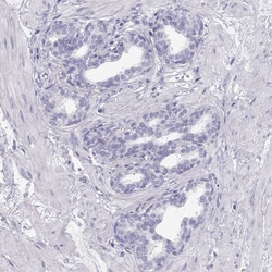 Invitrogen TKTL1 Polyclonal Antibody 100 &mu;L; Unconjugated:Antibodies,