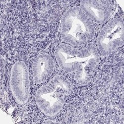 Invitrogen TKTL1 Polyclonal Antibody 100 &mu;L; Unconjugated:Antibodies,