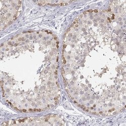 Invitrogen TKTL1 Polyclonal Antibody 100 &mu;L; Unconjugated:Antibodies,