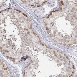 Invitrogen TKTL1 Polyclonal Antibody 100 &mu;L; Unconjugated:Antibodies,