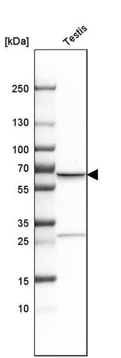 Invitrogen TKTL1 Polyclonal Antibody 100 &mu;L; Unconjugated:Antibodies,