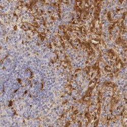 Invitrogen RENBP Polyclonal Antibody 100 &mu;L | Buy Online | Invitrogen&trade; | Fisher Scientific