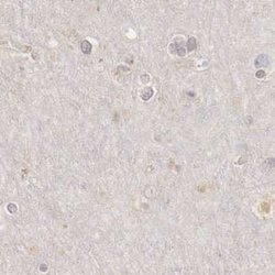 Invitrogen RENBP Polyclonal Antibody 100 &mu;L | Buy Online | Invitrogen&trade; | Fisher Scientific