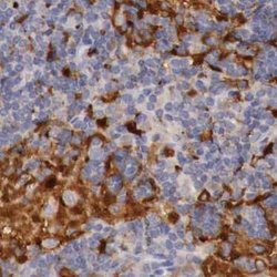 Invitrogen RENBP Polyclonal Antibody 100 &mu;L | Buy Online | Invitrogen&trade; | Fisher Scientific