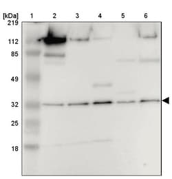 Invitrogen PITPNB Polyclonal Antibody 100 &mu;L | Buy Online | Invitrogen&trade; | Fisher Scientific